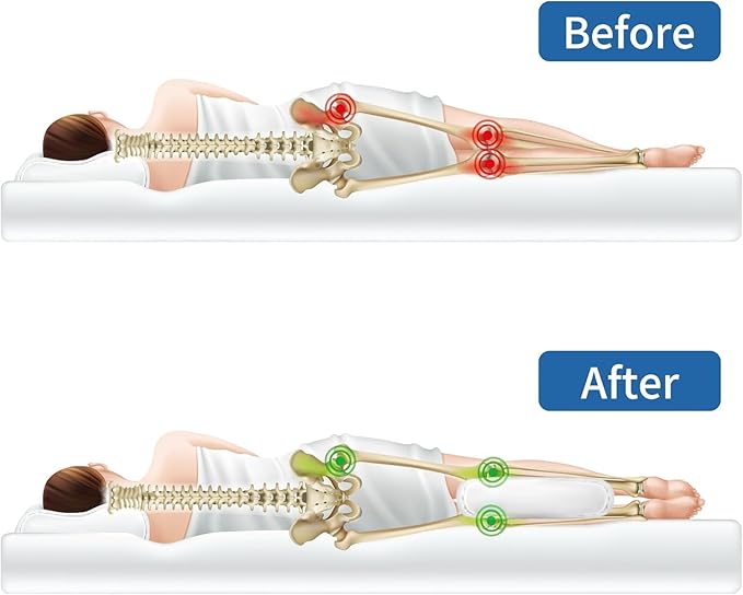 HOMBYS Cooling Knee Pillow for Side Sleepers with Straps-4 in Thick Leg Pillow for Spine Alignment, Lower Back Pain Relief - Pillow Between Legs Supportive and Breathable