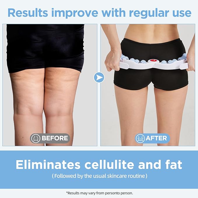 Cellulite Massage Tool Deep Fascia Massager & Dimpled Skin Remover for Legs - Anti-Cellulite Roller Tech with Lymphatic Drainage, Smooth Skin & Pain Relief for Thighs & Buttocks Sculpting