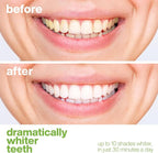 AquaSonic Professional Teeth Whitening Strips - Enamel Safe Teeth Whitening with Hydrogen Peroxide - Easy to Use, Non-Slip, Affordable & Effective (Spearmint)