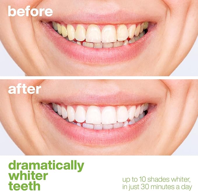 AquaSonic Professional Teeth Whitening Strips - Enamel Safe Teeth Whitening with Hydrogen Peroxide - Easy to Use, Non-Slip, Affordable & Effective (Spearmint)