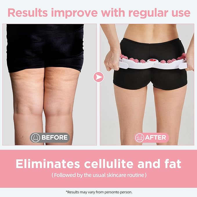 Cellulite Massage Tool Deep Fascia Massager & Dimpled Skin Remover for Legs - Anti-Cellulite Roller Tech with Lymphatic Drainage, Smooth Skin & Pain Relief for Thighs & Buttocks Sculpting