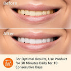 Amazon Basics 10 Day Teeth Whitening Strips Kit, 10 Treatments, 1-Pack (Previously Solimo)