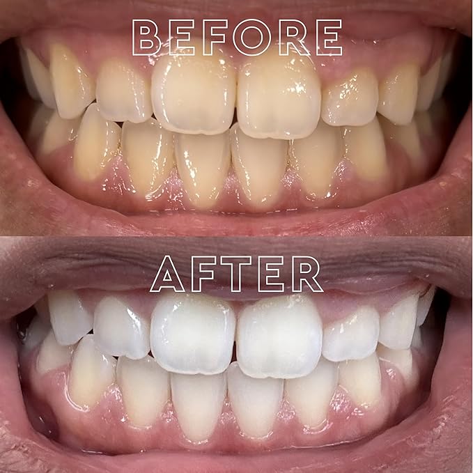 MOON Dissolving Teeth Whitening Strips - Vegan, Easy-to-Use White Strips - Dissolve in 15 Minutes & Designed to Gently Whiten Sensitive Teeth Up to 7 Shades in 2 Weeks, Midnight Mint (56 Count)